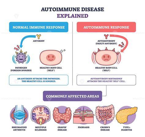 autoimmune disease attacking body