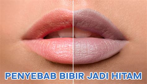 bibir hitam