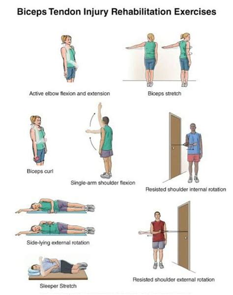 bicep tendonitis exercises nhs