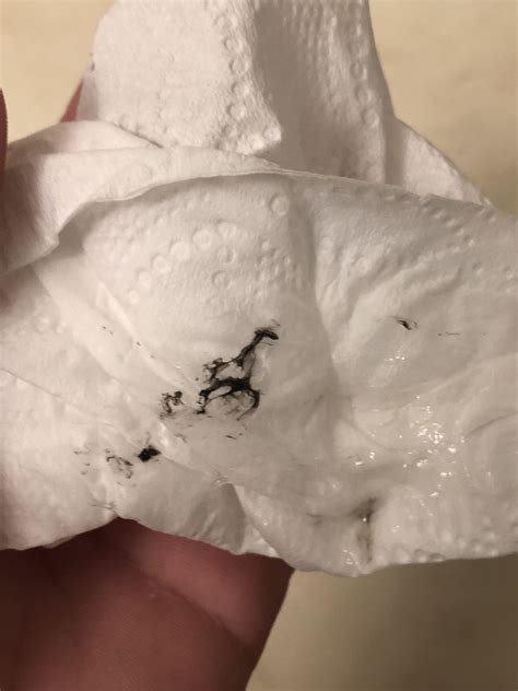 black specks in snot when blowing nose