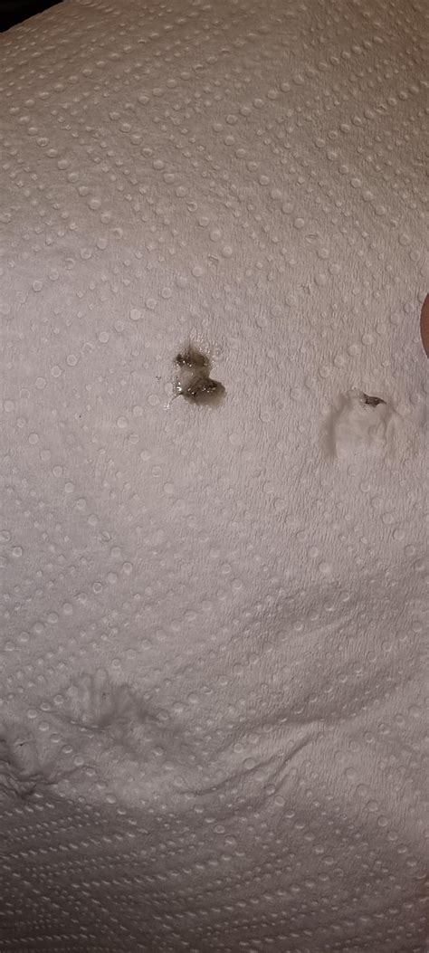 black stuff when blowing nose