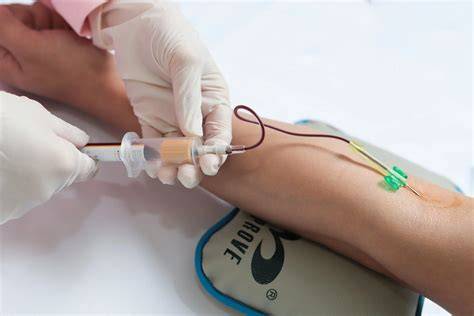 Blood sample collection