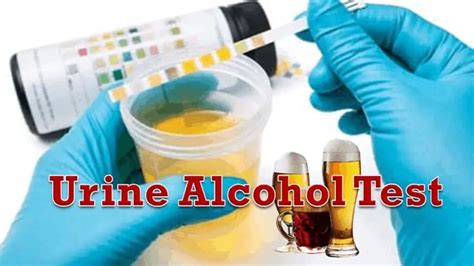 can alcohol be tested in pee