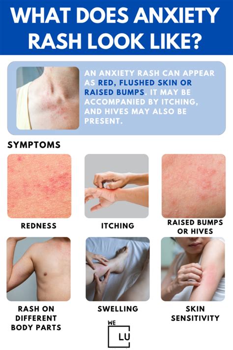 can anxiety cause skin problems
