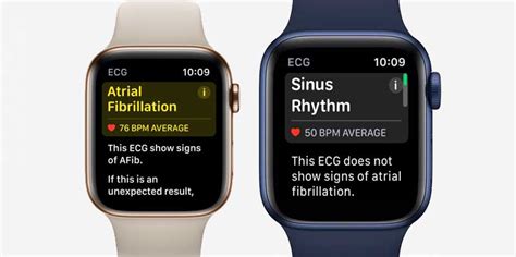 can apple watch detect svt