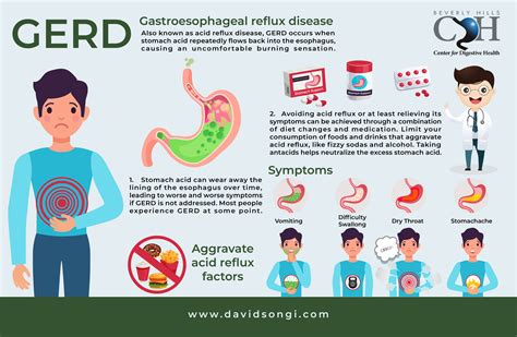 can gerd be caused by stress