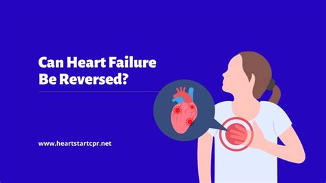 can heart failure be reversed with exercise