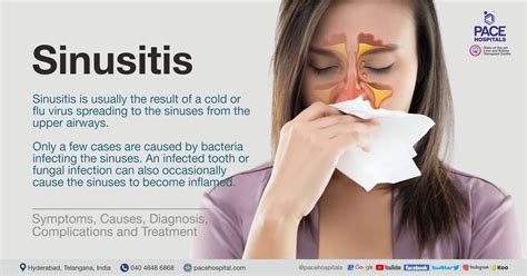 can sinusitis be misdiagnosed