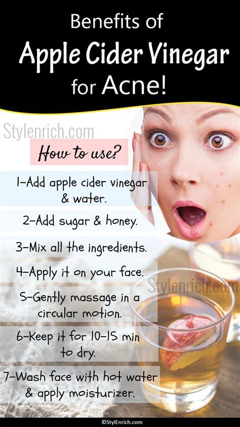can we apply apple cider vinegar on face overnight