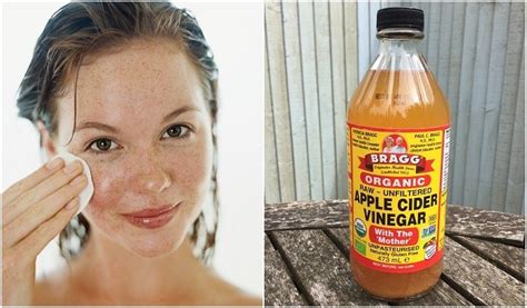 can we put apple cider vinegar on face overnight