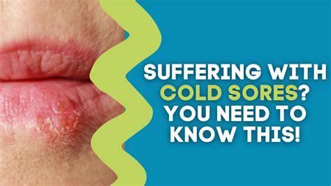 can you get cold sores randomly