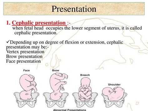 cephalic presentation meaning in urdu