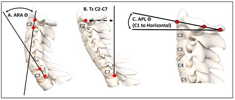cervical spine in spanish translation