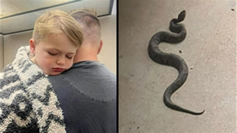 child bitten by snake