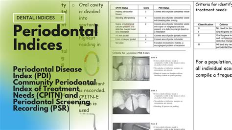 code for periodontics