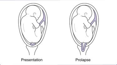 cord presentation define