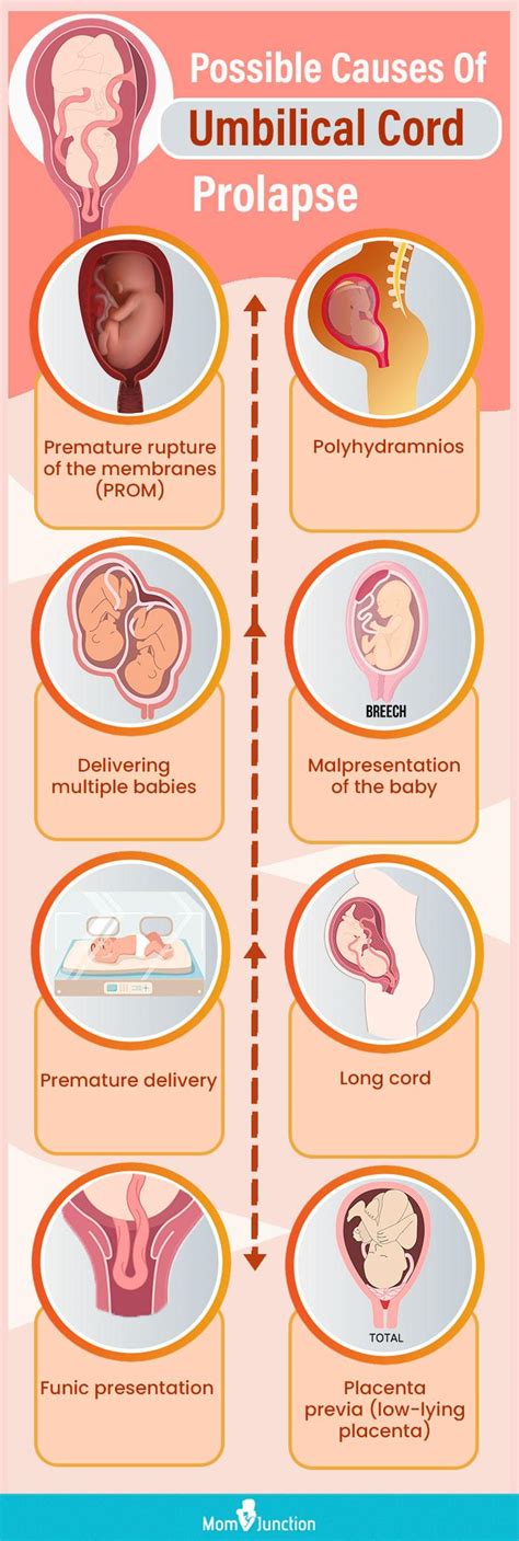 cord presentation symptoms
