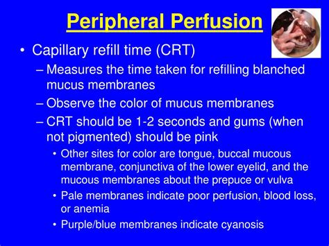 decreased peripheral perfusion meaning