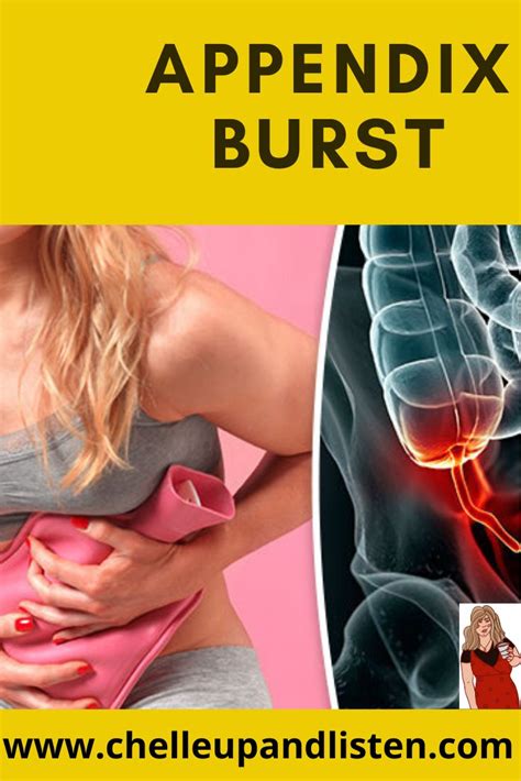 define appendix burst