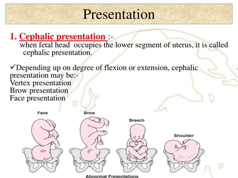 definition of lie and presentation in obstetrics