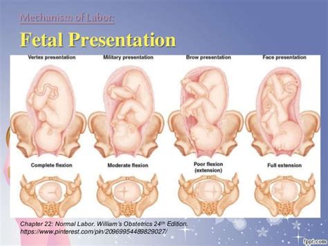 definition of presenting part in obstetrics
