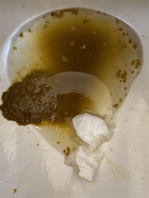 diarrhea when stressed reddit