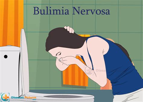 does anxiety cause bulimia