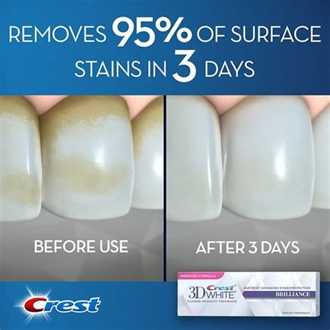 does crest 3d white toothpaste damage your teeth