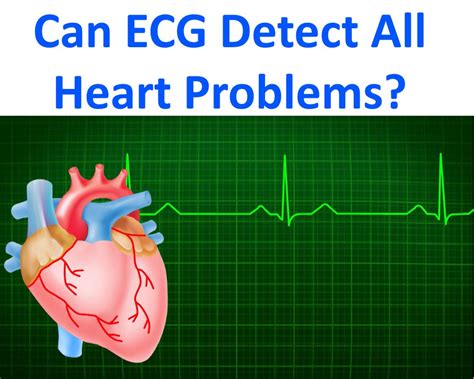 does ecg can detect heart problems