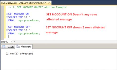 does not contain sql server