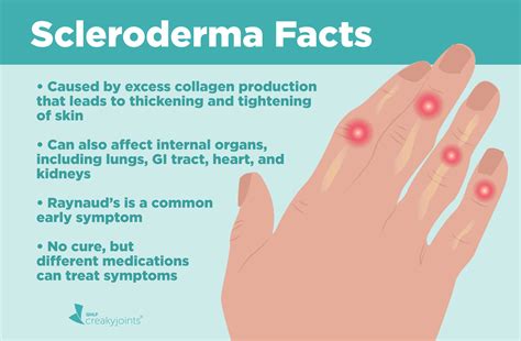 does scleroderma always affect the face