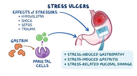 does stress affect stomach ulcers
