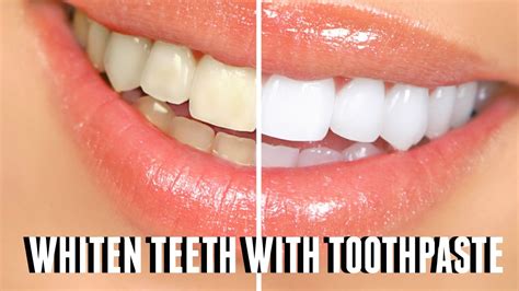does toothpaste whiten teeth reddit