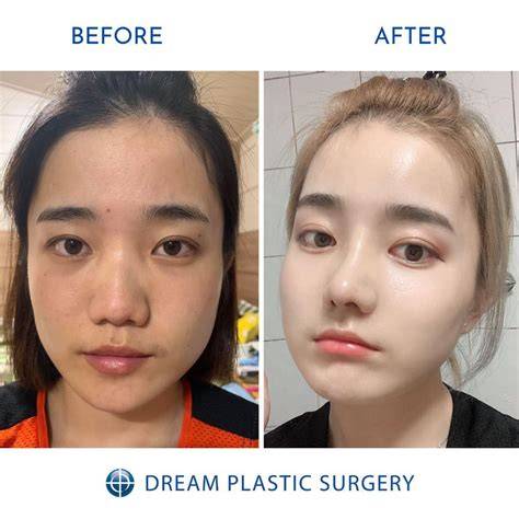 Hasil Operasi dalam Mimpi
