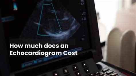 Echocardiogram Cost