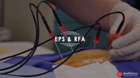eps rfa full form