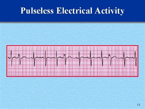 examples of pulseless electrical activity