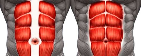 exercises to fix abdominal separation for men