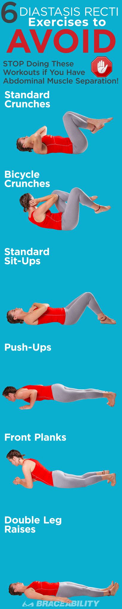 exercises to help abdominal separation