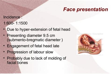 five causes of face presentation
