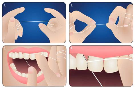 flossing
