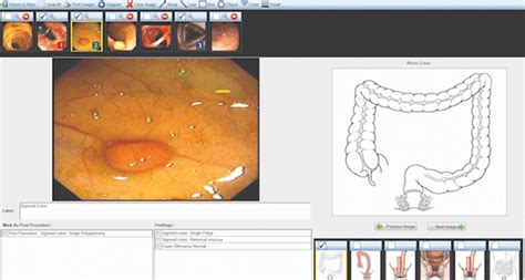 Gastroenterology Software Walkthrough