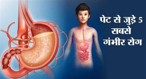 gastrointestinal problem in hindi