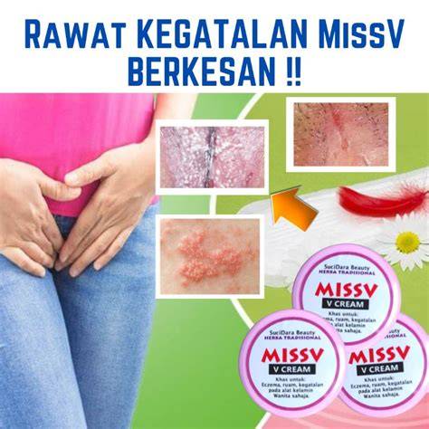 gatal miss v