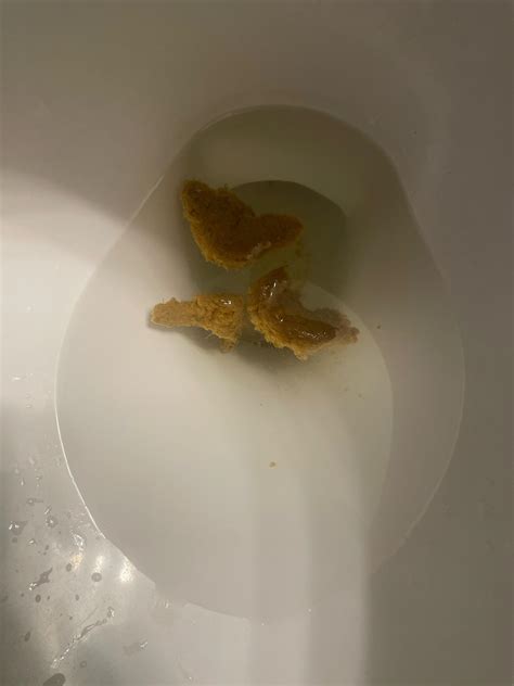 having to poop and anxiety
