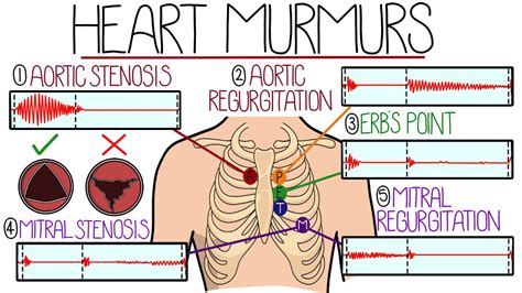 how do you get rid of a heart murmur naturally