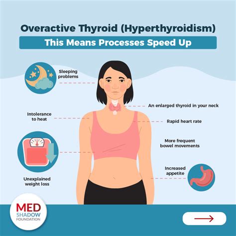 how does an overactive thyroid affect your body