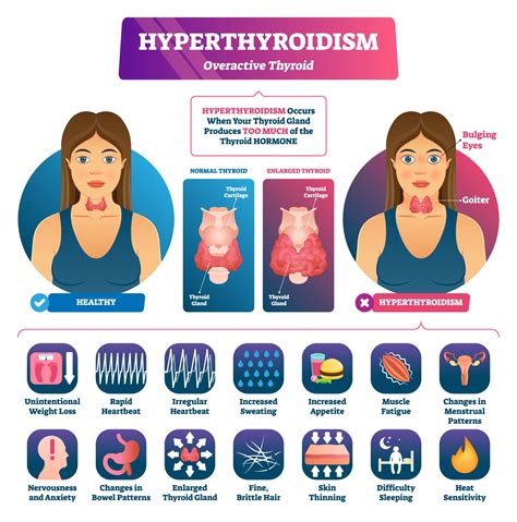 how does an overactive thyroid affect your weight