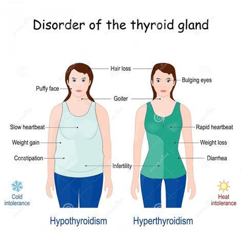 how does hyperthyroidism affect other body systems