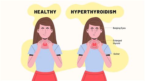 how does hyperthyroidism affect your body